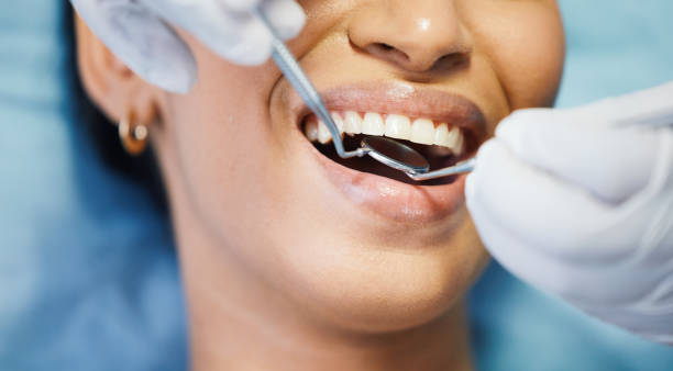 Best Emergency Broken Tooth Repair in Oxoboxo River, CT